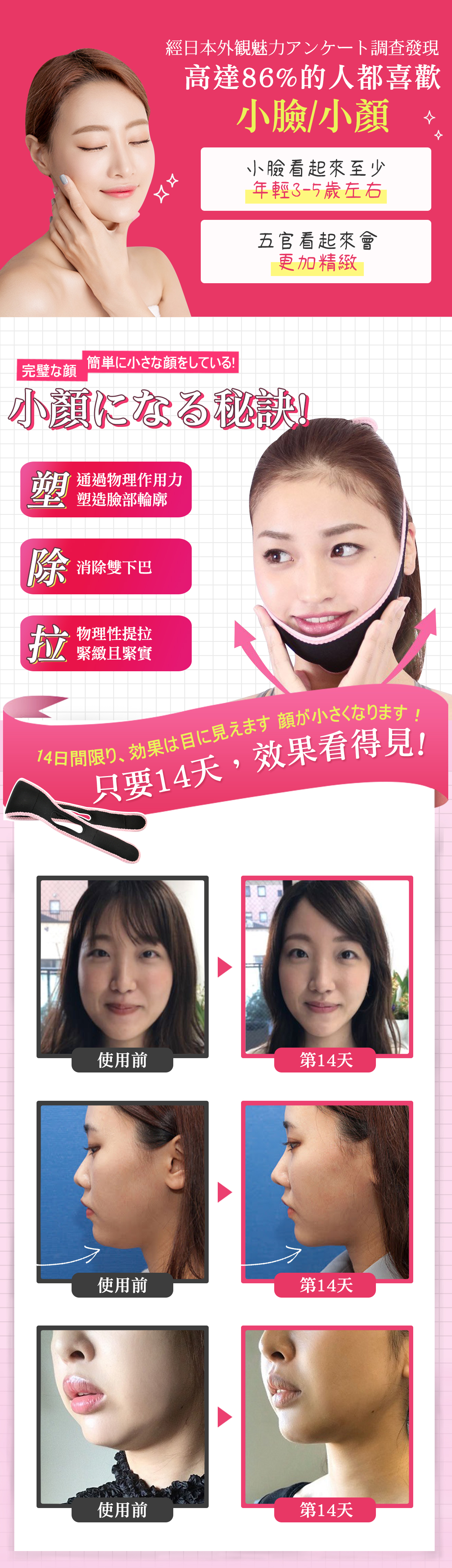 修修臉V型縮臉帶